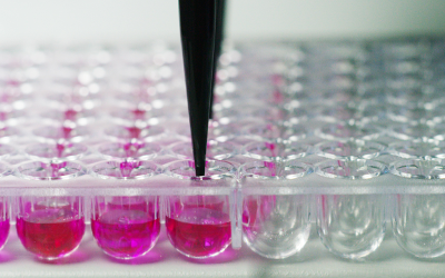 Metastatic Breast Cancer