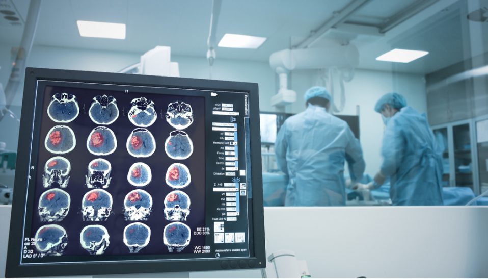 Covid-19 Cancer Treatment Options for Brain Tumor Patients