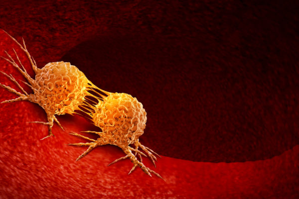 Physical traits of cancer