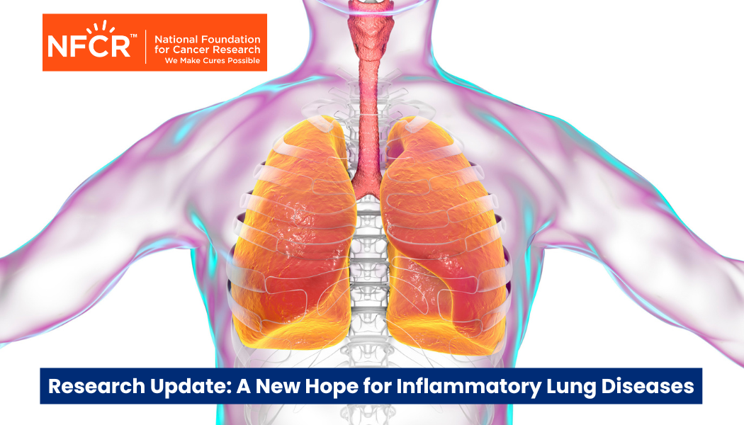 Research Update A New Hope for Inflammatory Lung Diseases Lung Disease