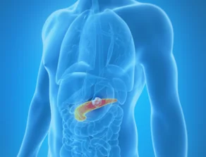 Pancreatic Cancer Location