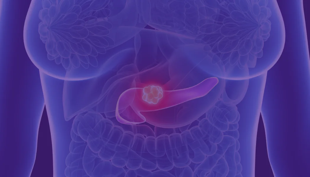 Pancreatic Pancreatic