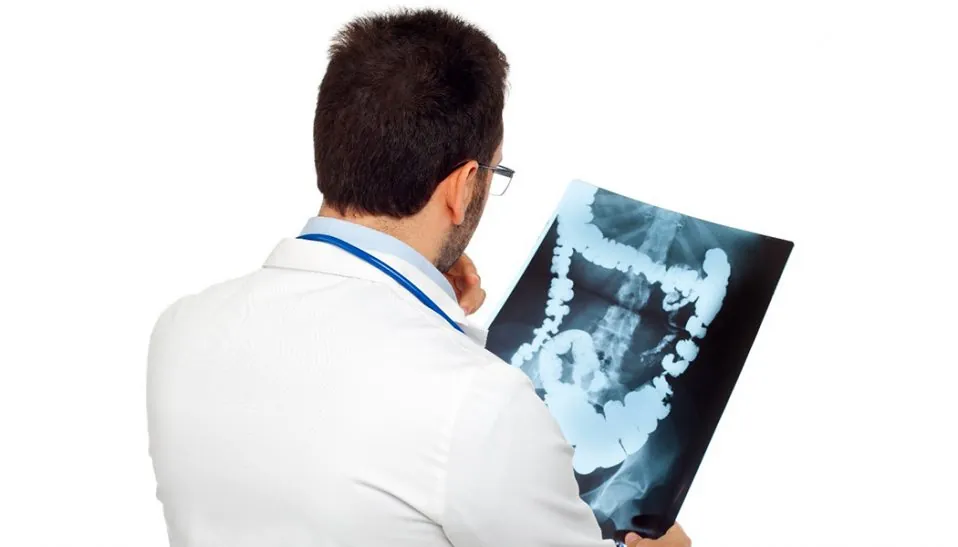 Doctor Examines Colorectal x-ray