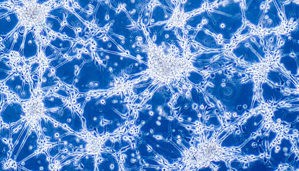 glioblastoma achilles heel
