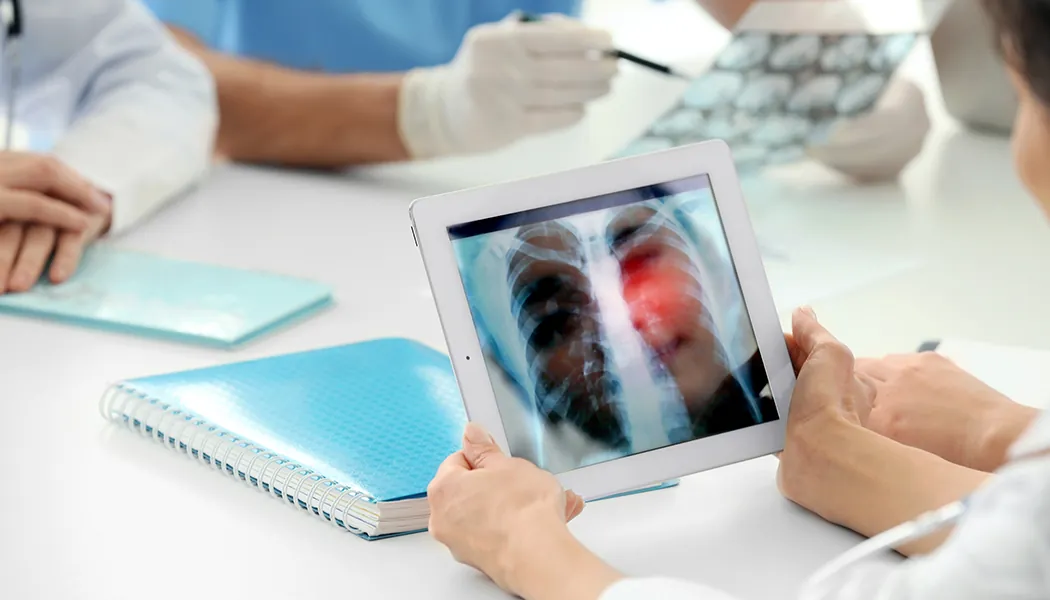 Assessing lung cancer treatment options