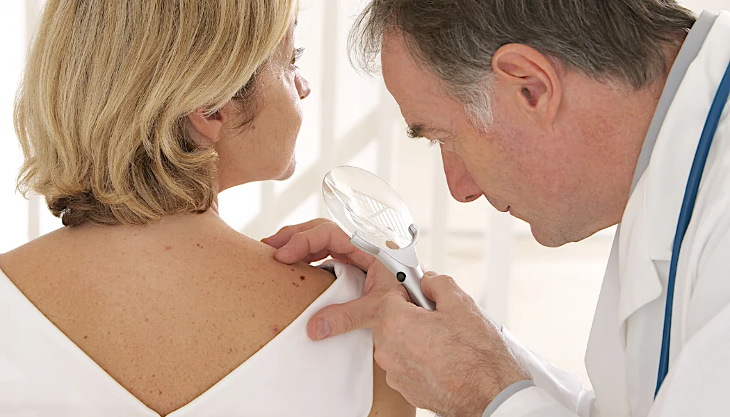 Melanoma Blog Feature Images Early Detection of Melanoma