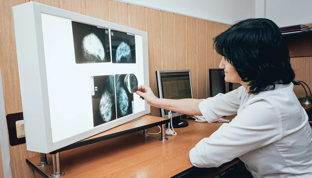 mastectomy 101 Mastectomy 101