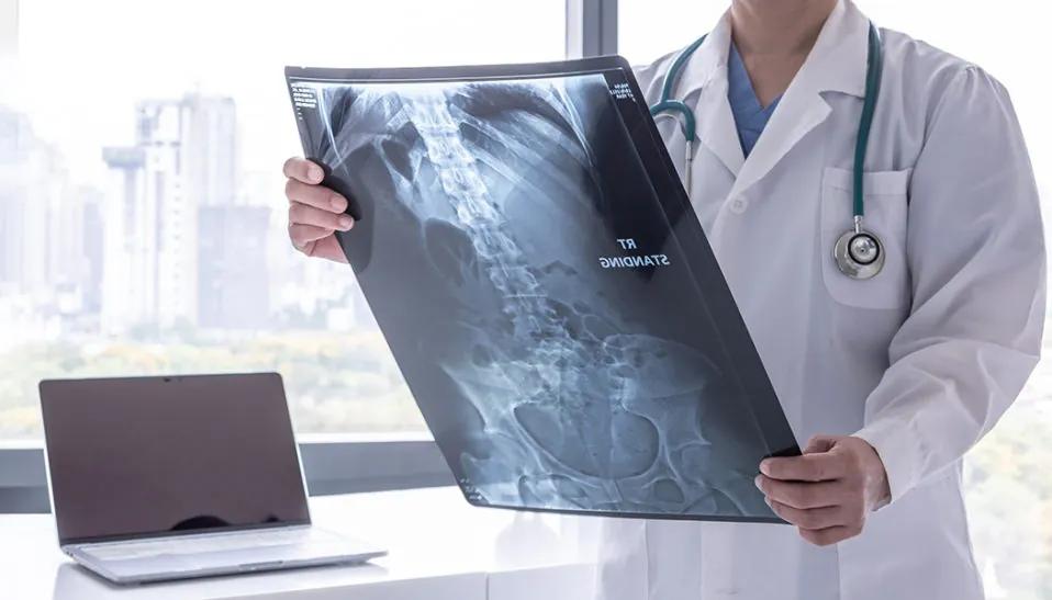 Esophageal Cancer Facts (X-ray)