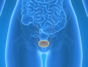 bladder-cancer